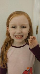 second child with missing tooth